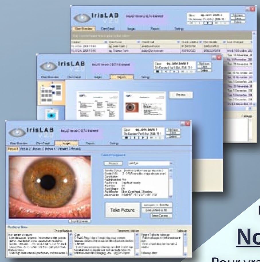 IrisMapper 2007 Version