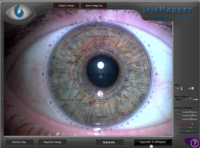 IrisMapper 2015 Custom Mapping