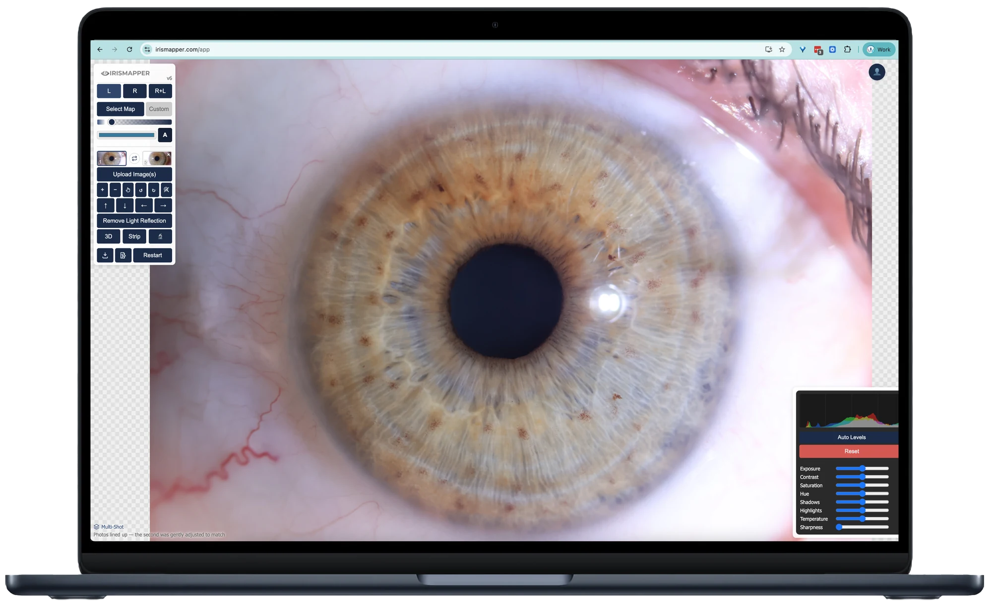 The same iris in 3D relief, its raised and sunken structure visible