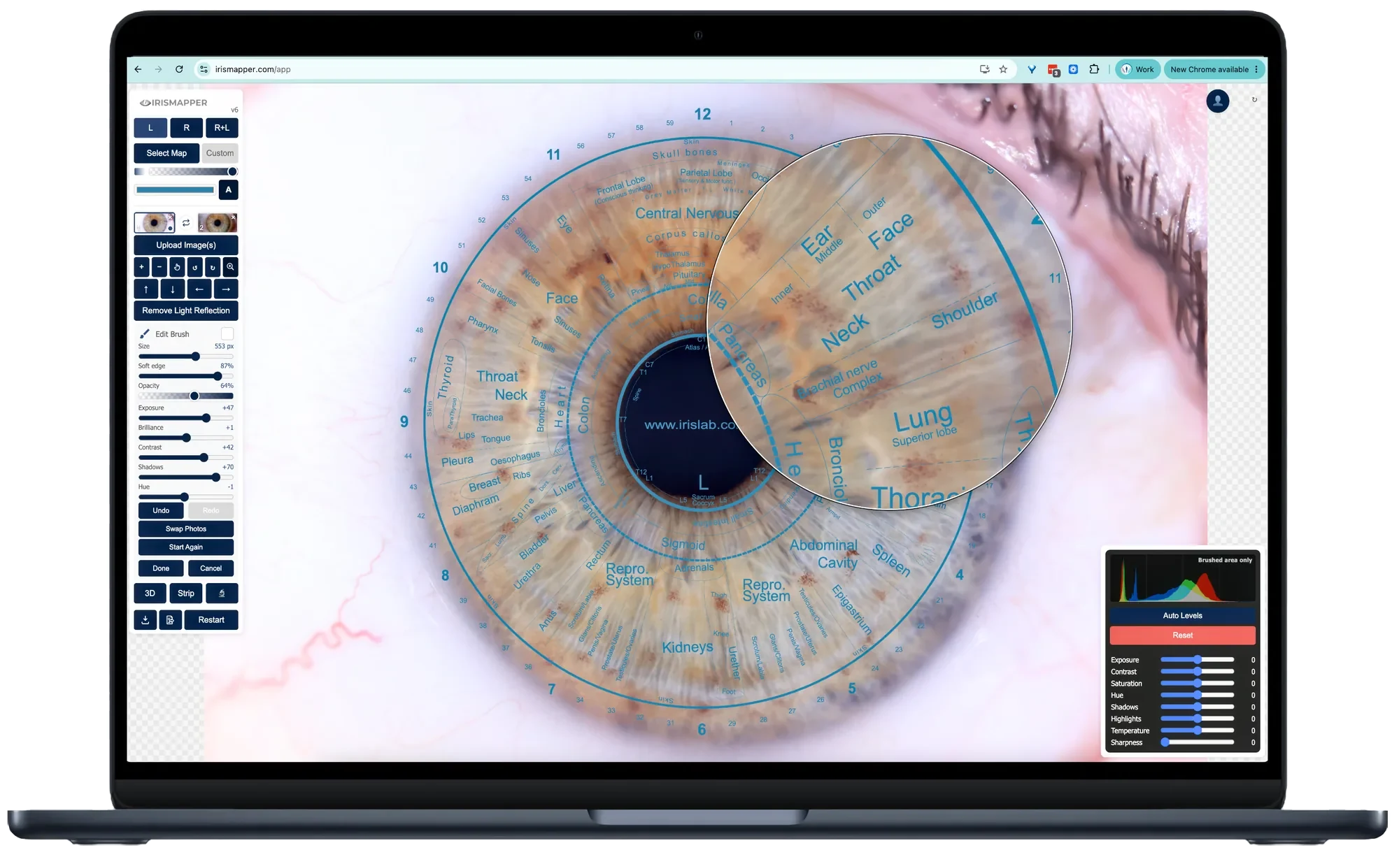 The same laptop with the magnifier held over the chart, enlarging the ear, face, throat, neck, shoulder and lung zones beneath it