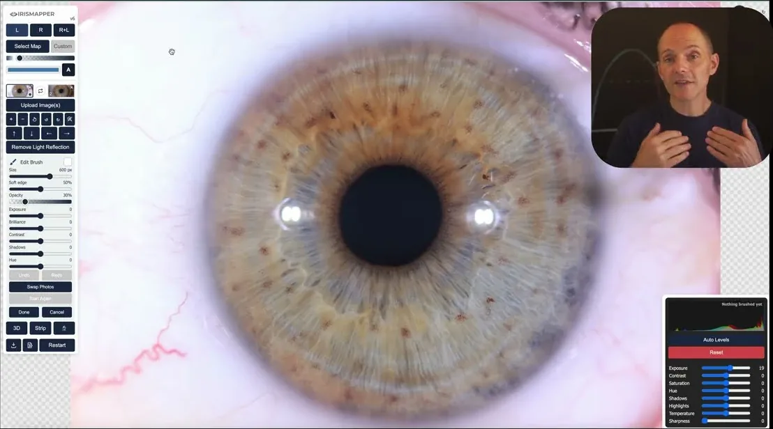Demo film: IrisMapper v6 finding what an iris photograph hides