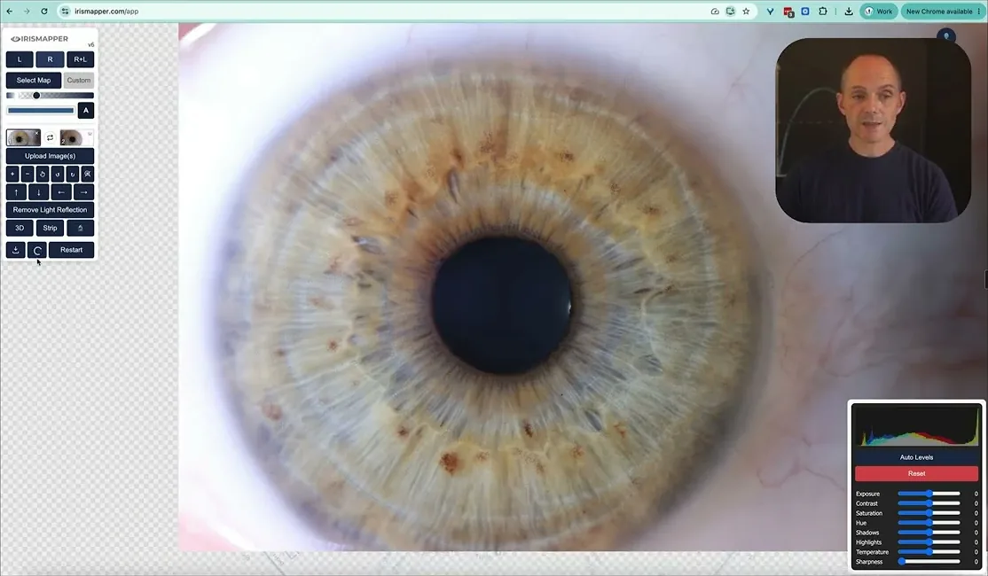 Demo film: the six IrisMapper v6 Advanced features shown on a real iris
