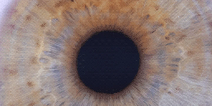 The same iris in v6 Advanced: both reflections gone, the fibres they were covering now visible
