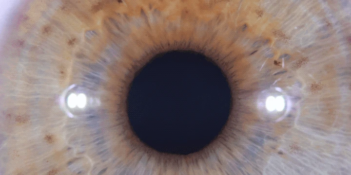 An iris photographed under two lights: a bright reflection sits on each side of the pupil, covering the fibres beneath